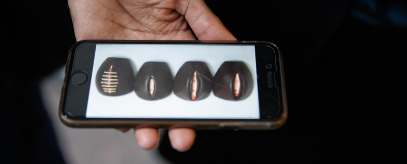 En bild visas på en iPhone på modeller av de fyra olika typerna av kvinnlig könsstympning.